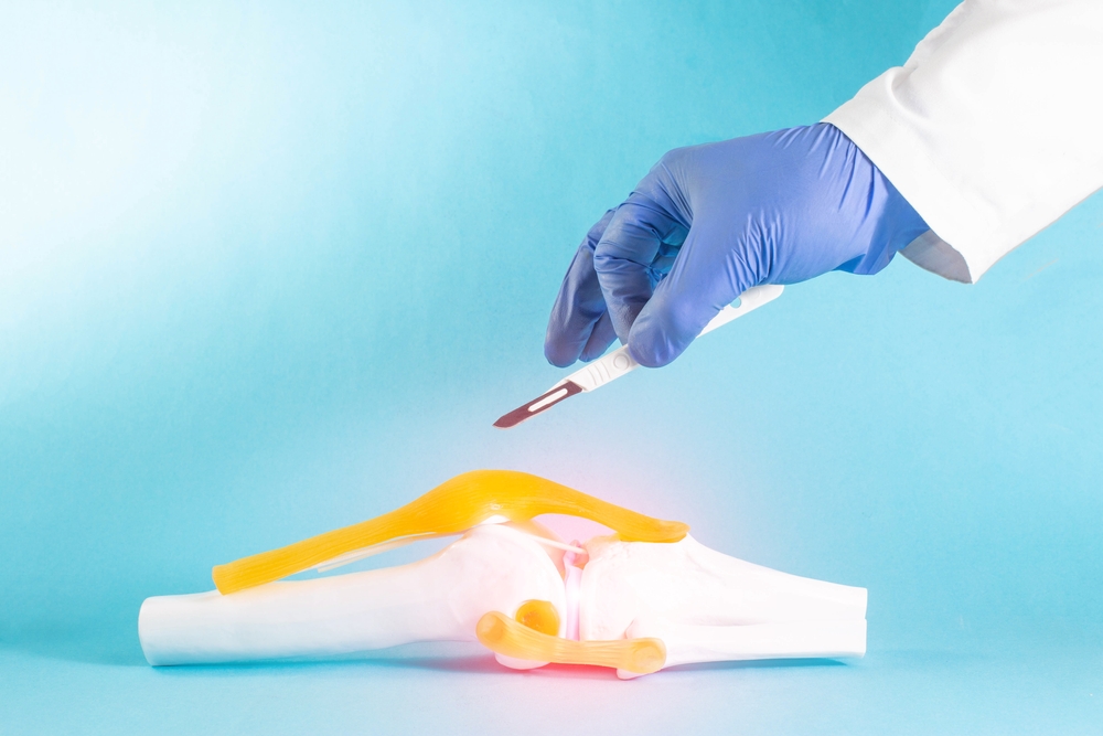 Arthroscopy