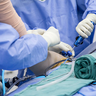 Keyhole Shoulder Arthroscopy In Guntur